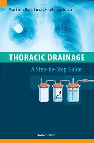Medicína - ostatné Thoracic Drainage / A Step-by-Step Guide - Kolektív autorov